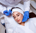 מילוי קמטים: זריקת נעורים-תמונה